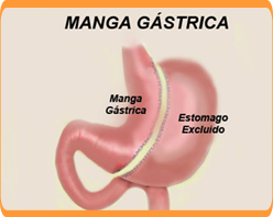 Slider image (3) C.I.O.L: Centro Integral de Obesidad y Laparoscopia | Spanish Center